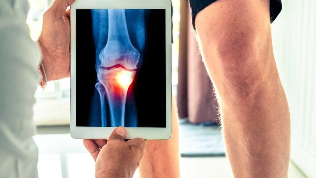 Knee Pain Management – A Complete Guide for Healthcare Professionals ...