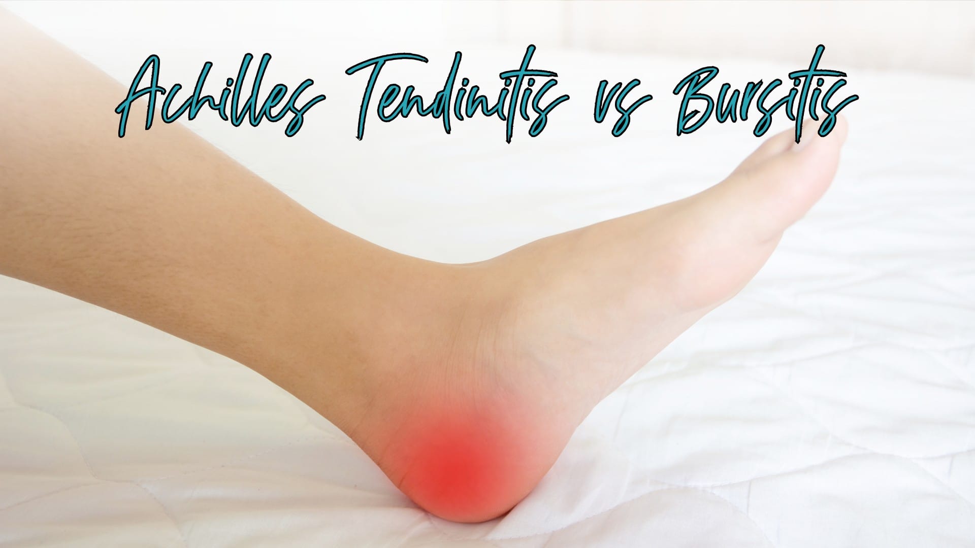 Achilles Tendinitis vs Bursitis_ What is the Difference (3)