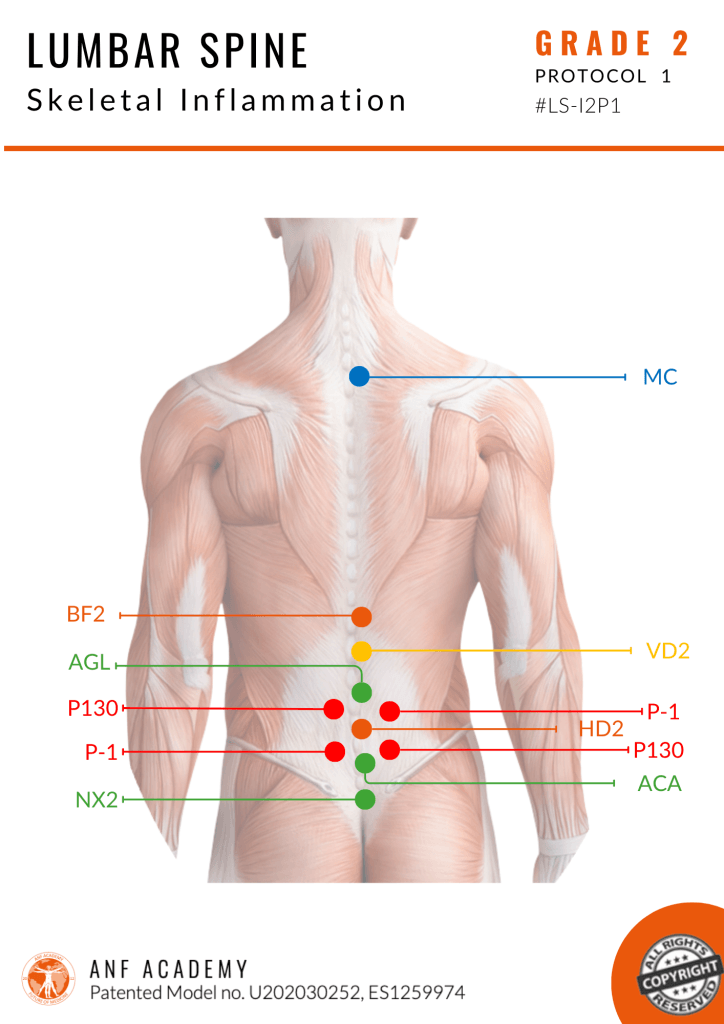 Lumbar Spine Skeletal Inflammation